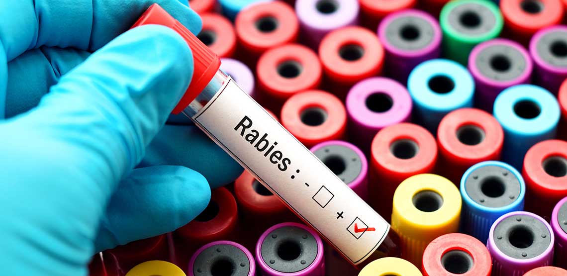 The rabies vaccine
